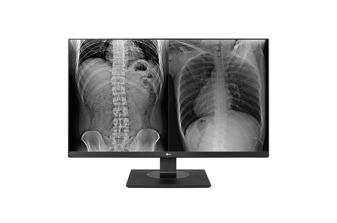 LG 27'' UHD 8MP klinisk vurderingsmonitor, 27HJ713C-B