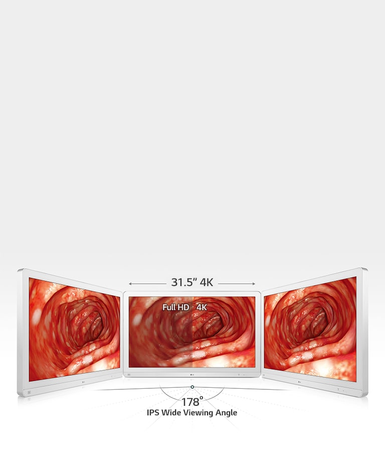 Ecran chirurgical 4K 32" 32HL710S-W - Ecrans 4K HD - Ecrans  chirurgicaux - Ecrans de diagnostic médical - Matériel Imagerie médicale 