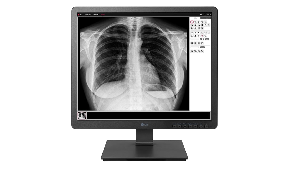LG 19.3'' 1.3MP IPS Clinical Review Monitor, 19HK312C