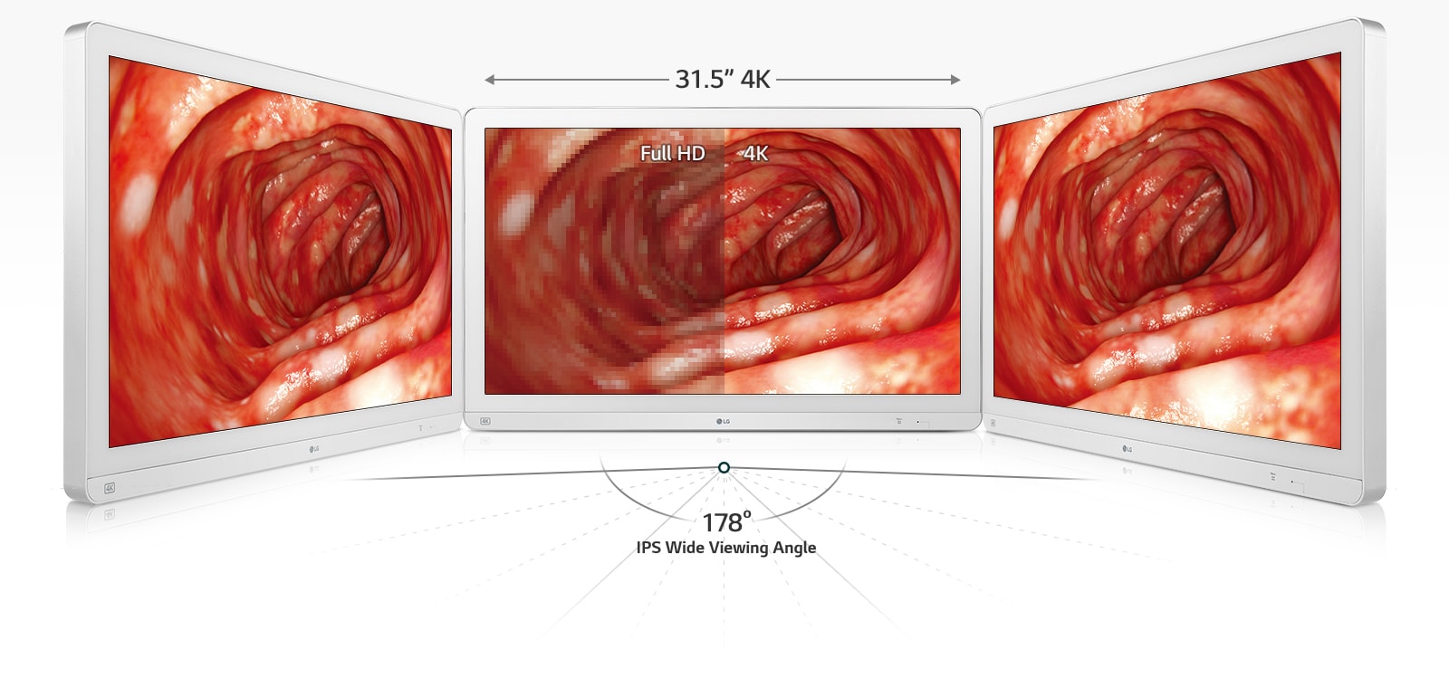 lg surgical monitor