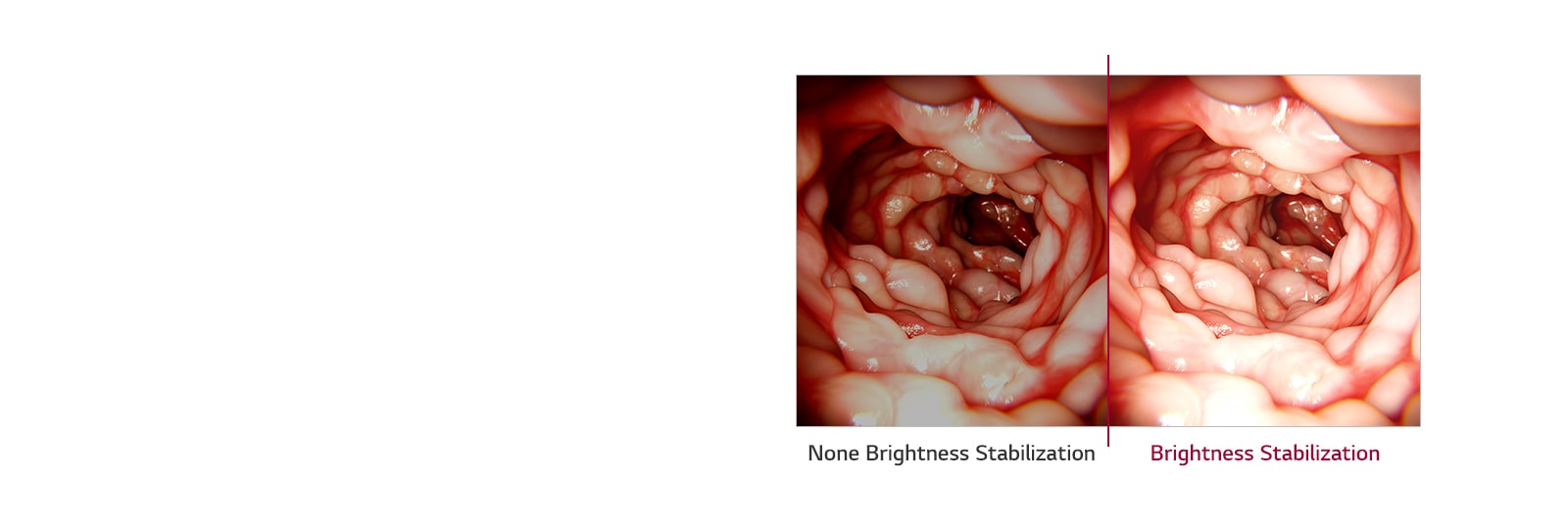 None Brightness Stabilization VS. Brightness Stabilization