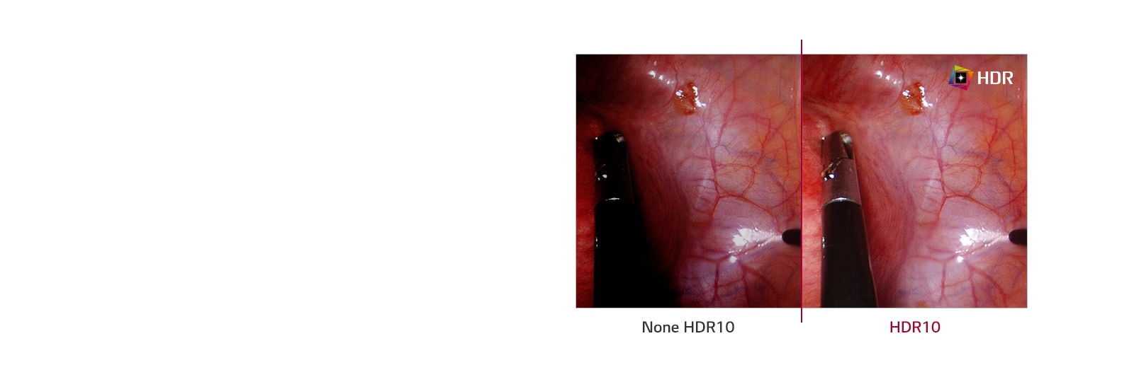 None HDR10 VS. HDR10