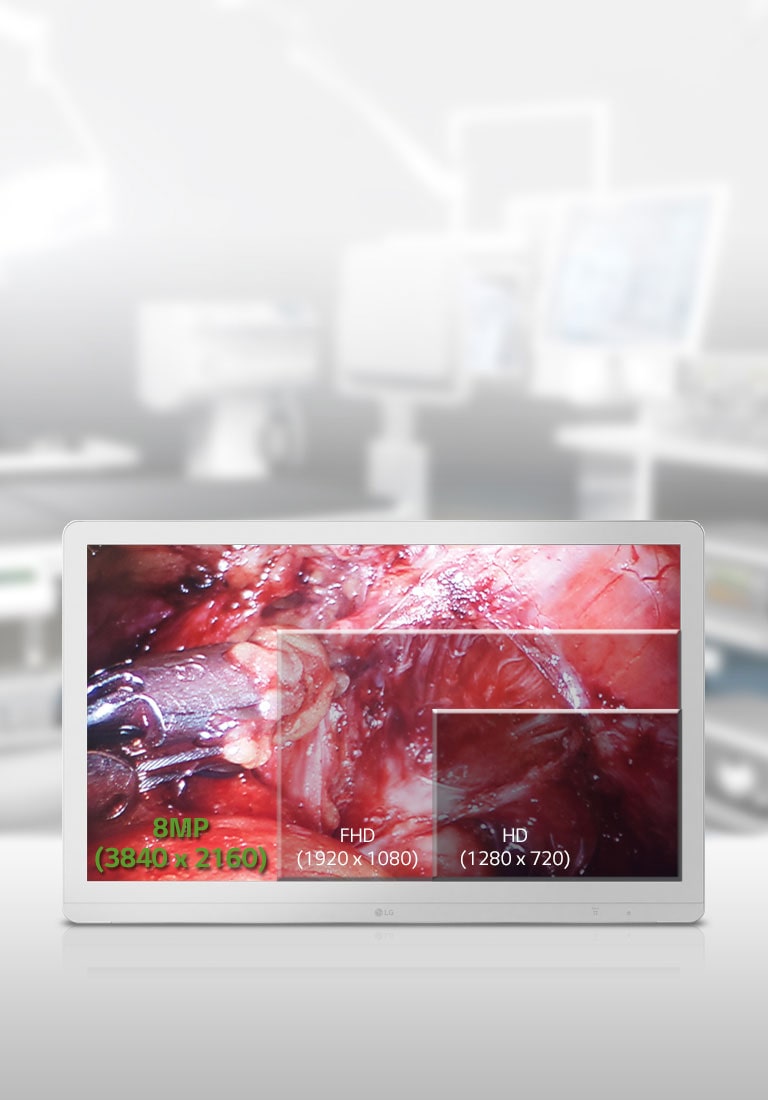 lg surgical monitor