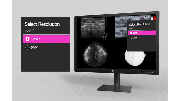 LG 31'' 12MP 4200 x 2800 IPS Diagnostic Monitor for Mammography l 31HN713D  l LG GLOBAL