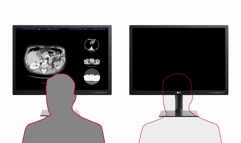 LG 31'' 12MP 4200 x 2800 IPS Diagnostic Monitor for Mammography l 31HN713D  l LG GLOBAL
