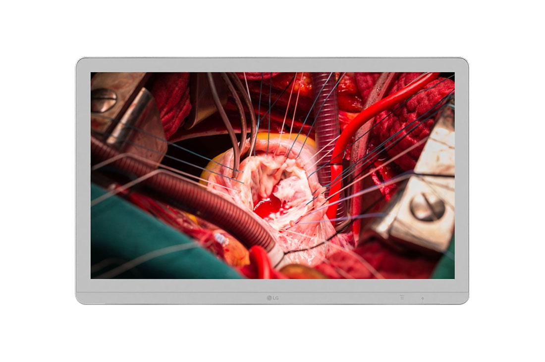 LG  LG 27'' 4K UHD IPS Surgical Monitor, Front view, 27HJ713S