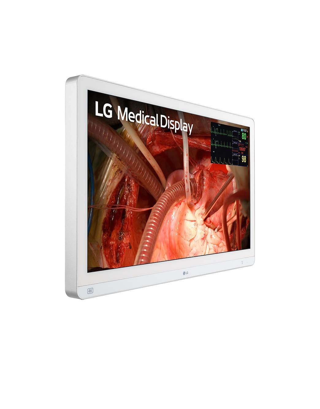 LG 27HQ710S: 27-inch 4K Surgical Monitor with Mini-LED | LG Global