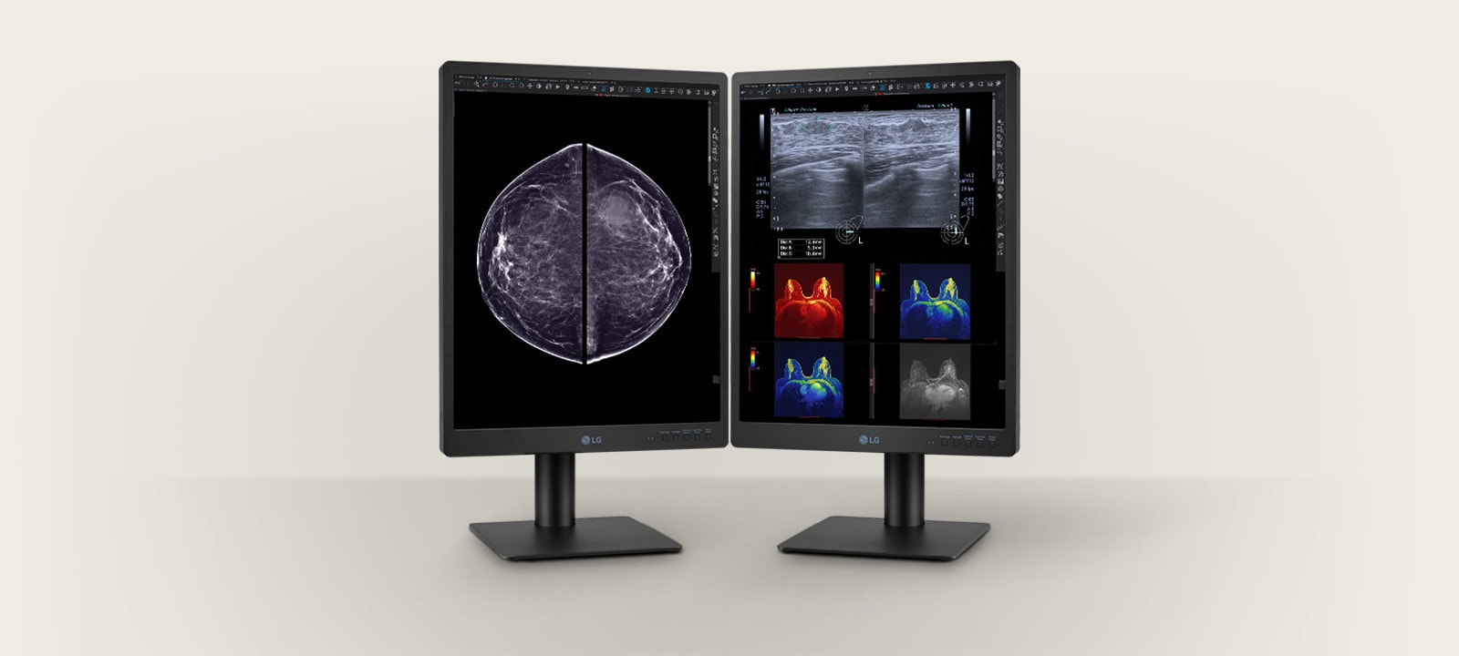 Diagnostic Monitor 21HQ613D displays radiological images, including full field digital mammography and digital breast tomosynthesis, with a brightness of 1,100 cd/m² and a contrast ratio of 1,800:1.