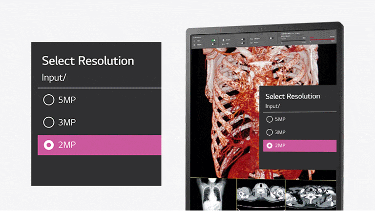 The various resolution modes (5/3/2MP) of the 21HQ613D allow users to customize their resolution to better fit their respective needs.