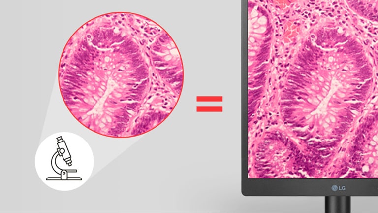 With Pathology mode, this diagnostic monitor provides image clarity and accuracy as if you were looking at a microscope.