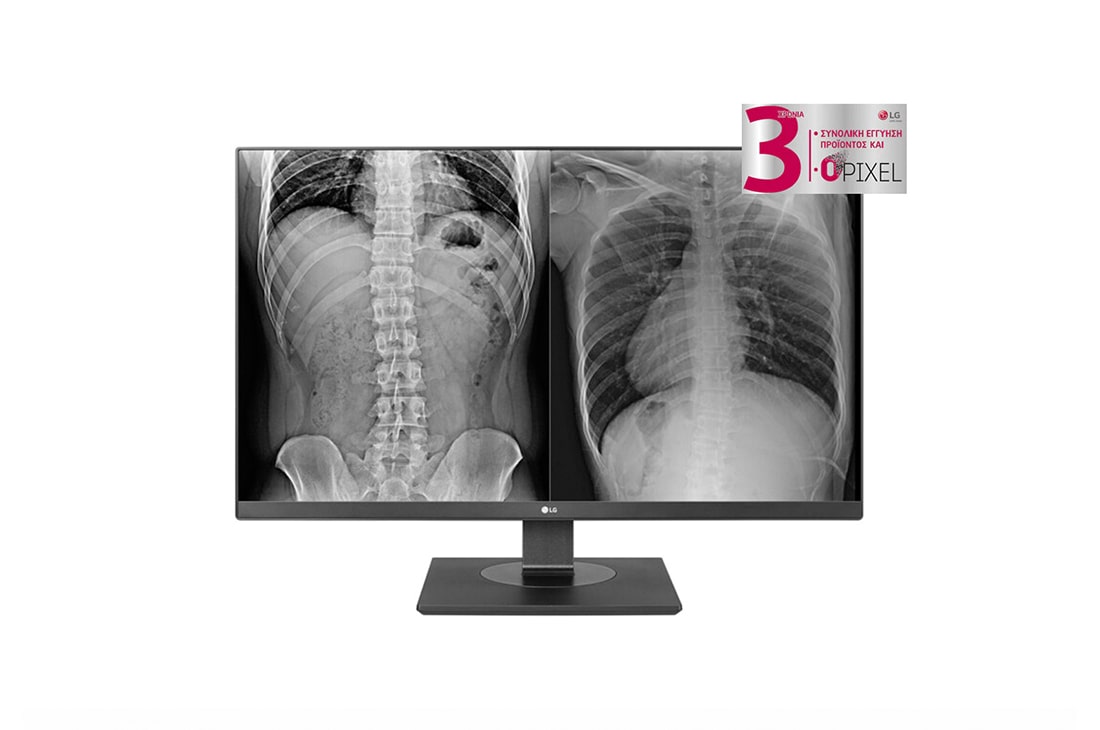 LG 27” Μόνιτορ εφαρμογών κλινικής αξιολόγησης 8 MP LG, 27HJ713C-B