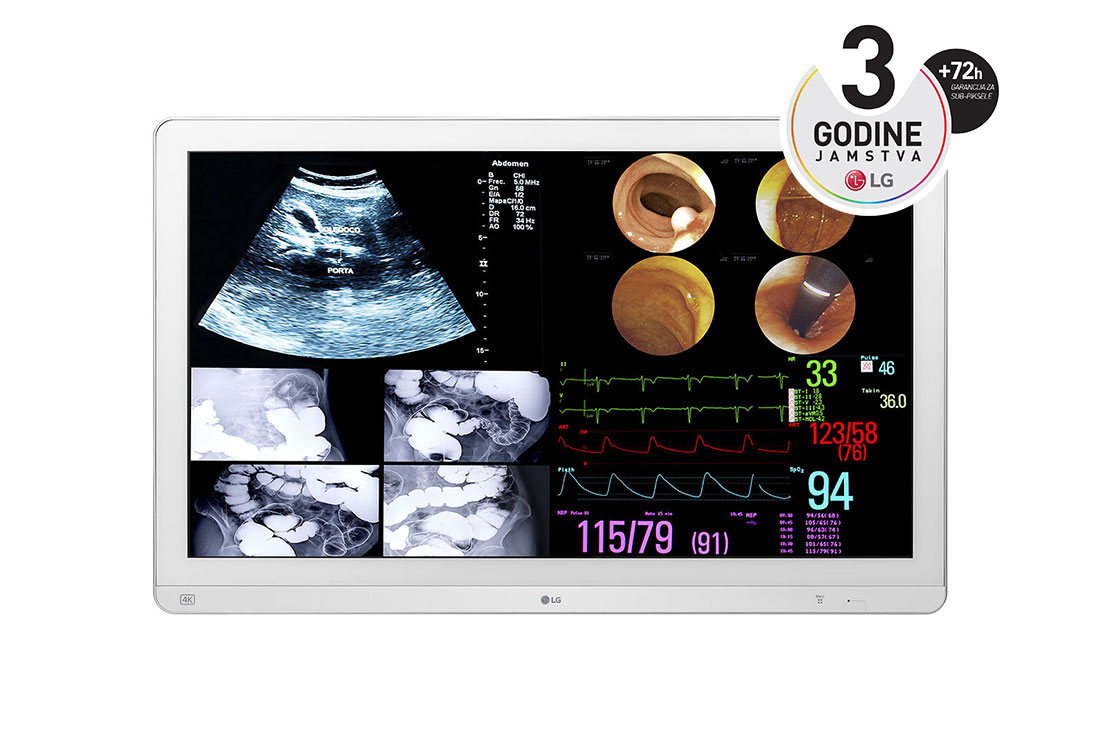 LG 31,5'' 4K(3840x2160) IPS kirurški monitor, prikaz prednje strane, 32HL714S-W