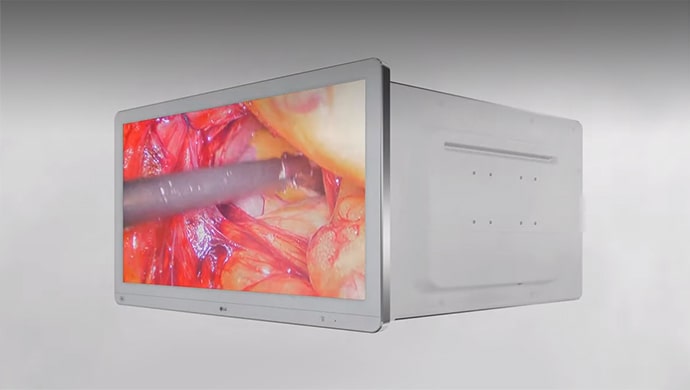 Videominiatuur : Introductie tot chirurgische monitors van LG