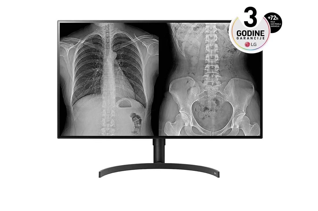 LG 32” 16:9 IPS medicinski monitor 8MP, front view , 32HL512D-M