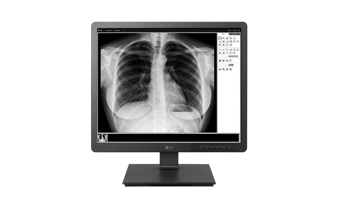 LG 19'' Klinički monitor za pregled od 1,3 MP, 19HK312C, 19HK312C-B