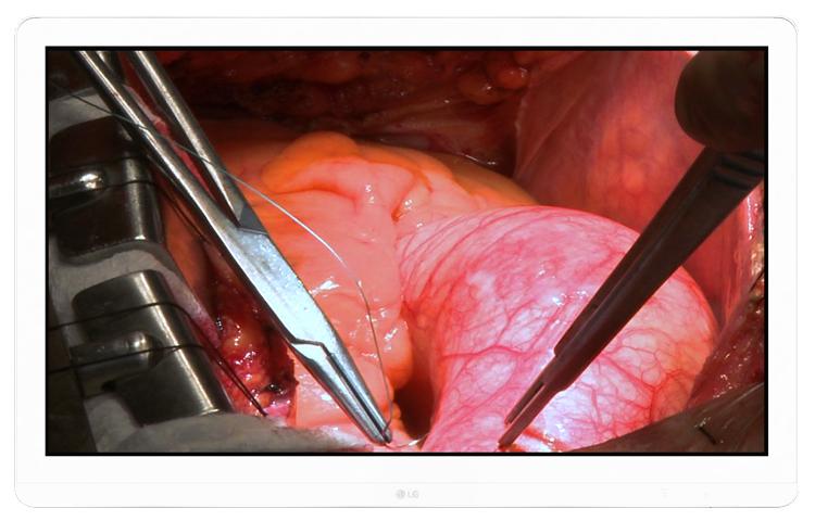 8MP Surgical Monitor1