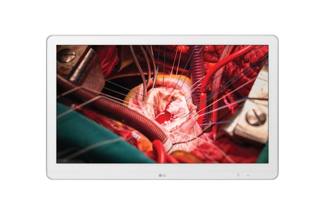 LG Màn hình phẫu thuật 27'' LG Full HD, 27HK510S-W