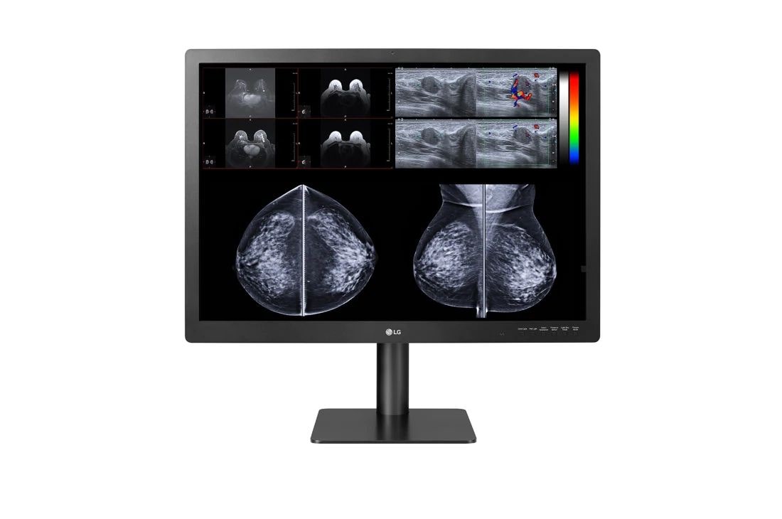LG Màn hình chẩn đoán LG 31'' 12MP IPS dành cho chụp nhũ ảnh, ảnh mặt trước với kết quả chụp nhũ ảnh đang hiện trên màn hình, 31HN713D